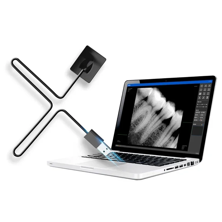 مستشعر أشعة سينية رقمي داخل ال - مراجعة Medical Supplies وسعره